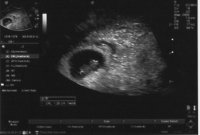 ultrasound042214online.jpg