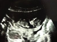 Baby #3 at 11 weeks.jpg