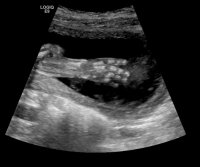 CNS-U S 18-22 WEEKS 0087.jpg