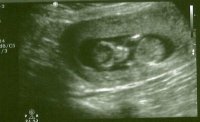 Ultrasound0003 2.jpg