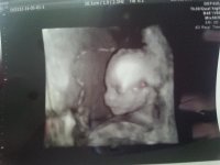 17wks050114.jpg