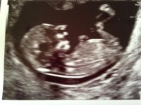 Baby scan 14.jpg