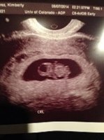 BABY9WEEK.jpg